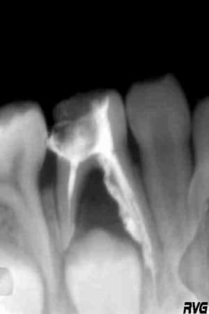 J 3 sem eenpvl - Eugenol