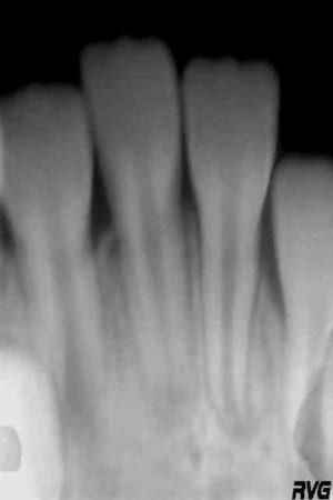 J plus deux mois xdtx8h - Eugenol