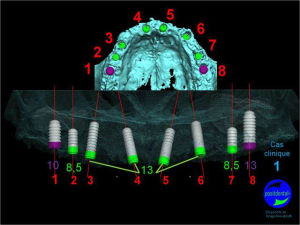 Mcd mise en charge diff r e01 sj4kde - Eugenol