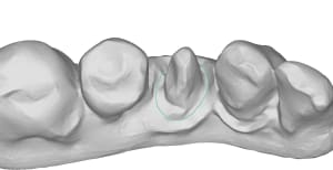 Mandibule 54 id85 ufzp48 - Eugenol