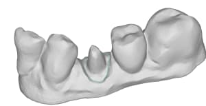 Mandibule 59 id85 ktmcfs - Eugenol