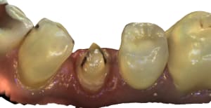 Mandibule 7 id85 aqjj3p - Eugenol