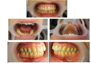 Mathieu 29 04 08 legtml - Eugenol