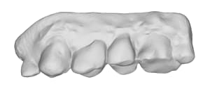 Maxillaire 5 id85 jzvtsf - Eugenol