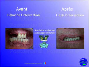 Mise en chage imm diate 029 wva9iq - Eugenol