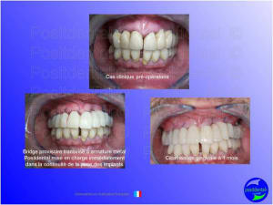 Mise en chage imm diate 048 bzhpgw - Eugenol