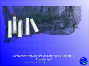 Mise en chage imm diate 104 c1fdtf - Eugenol
