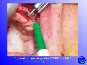 Mise en chage imm diate 141 tqvzsk - Eugenol