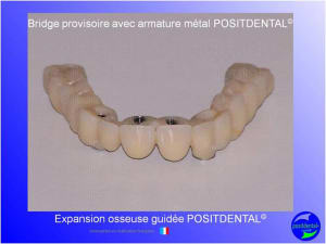 Mise en chage imm diate 163 ortq5a - Eugenol