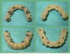 Mise en charge immédiade c - Eugenol