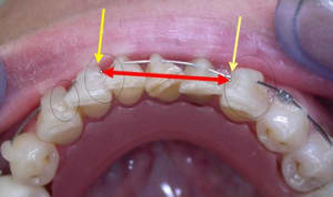 Mmm danchamons wgbnr4 - Eugenol