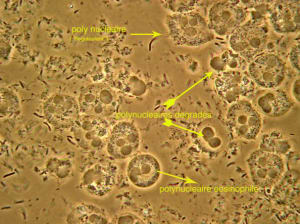 Neutrophiles ar2cy1 - Eugenol