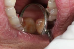 Oim molaires d eslwjz - Eugenol