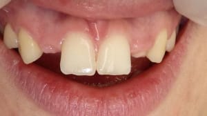 P1000225 spoxwv - Eugenol