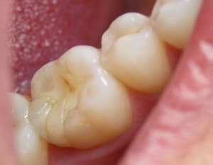 P1000729 qtwfg1 - Eugenol