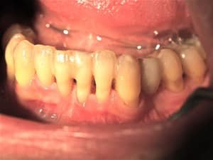 P1010638  zy49vf - Eugenol