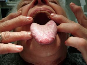 P6010083 pltcux - Eugenol