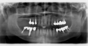Pano ls4ylp - Eugenol