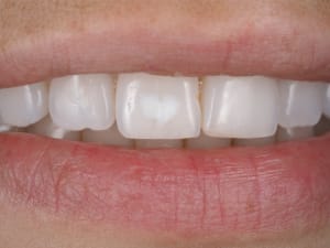 Pb070646  2  s7bdim - Eugenol