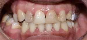 Pb140619 tflgqm - Eugenol