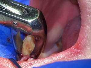 Positdental 141120 107 cdsvim - Eugenol