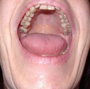 Photo 069 tecdms - Eugenol