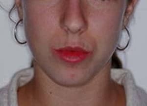 Picture2 a nezrpf - Eugenol