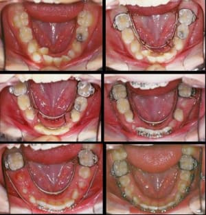 Picture aaa sdfvru - Eugenol