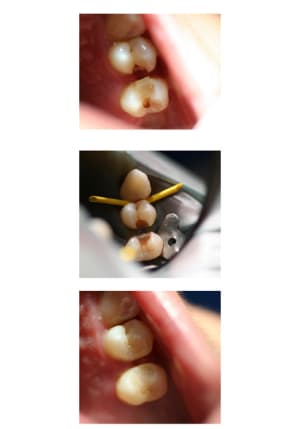 Planche contact 1 vl80bz - Eugenol