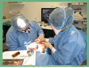 Pose d implants et d un bridge à armature métal en 1 seule intervention g - Eugenol