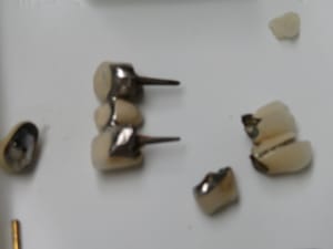 Positdental 181009 021 o7dkbn - Eugenol