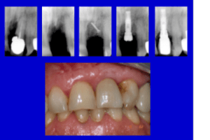 Projet1 jw9v9m - Eugenol