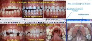 Qua helix 4 ans  xbgiop - Eugenol
