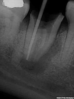 R25 sokyam - Eugenol