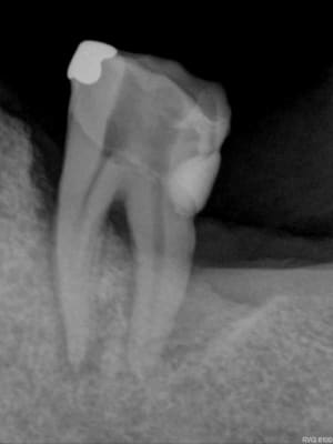 R26 szlxny - Eugenol