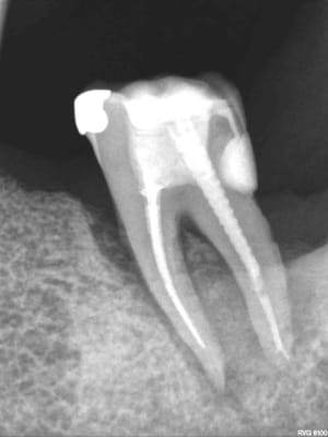 R52 kzrddz - Eugenol