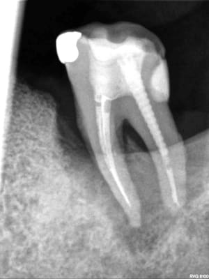 R69 qeompc - Eugenol