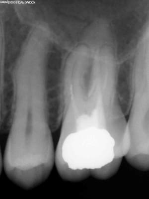 R6 fohwql - Eugenol