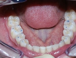 Rim1 n9brt8 - Eugenol