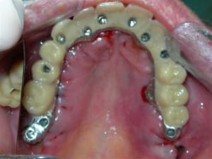 Rscn1877 pdwoof - Eugenol