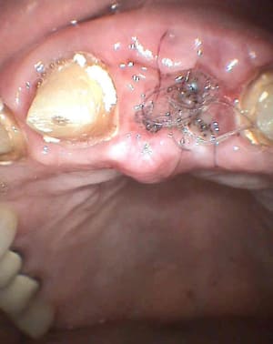 S28 zdombj - Eugenol