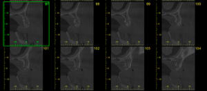 Scan4 cx0mxa - Eugenol