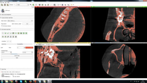 Slicer5 duhyg4 - Eugenol