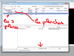 Slicer 4 avilyx - Eugenol