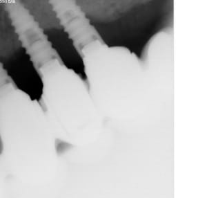 Sans titre s6zf9o - Eugenol
