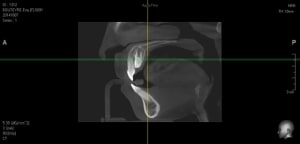 Sans titre uusjqu - Eugenol