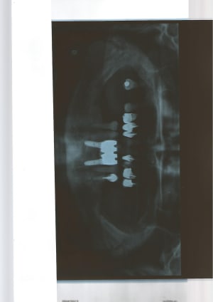 Scan 22 10 14 nfy65v - Eugenol