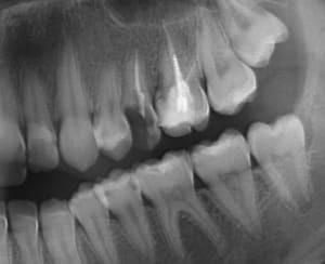 Screenshot333 q4ihve - Eugenol