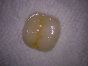 Stillcap0028 q8ooqh - Eugenol