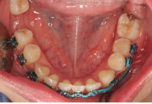 T4 wiyf6f - Eugenol